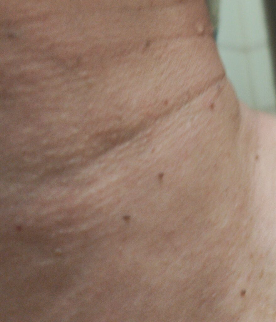 杏ジェルで黒ずみ・くすみ一掃!